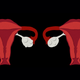 Image for article titled Woman Discovers She Has 2 Uteruses, 2 Cervixes, and Twins On the Way